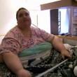 Penny pesa 272 chili: un bypass gastrico le salverà la vita05