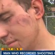 Polizia uccide aggressore nudo in Florida 02