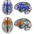 Cervello donne e cervello uomini, guarda la foto: funzionano diversamente Credit: Ragini Verma, PhD, Proceedings of the National Academy of Sciences