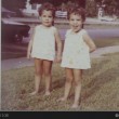 Amy e Becky Glass, gemelle dividono tutto: cibo, Fb, fidanzato 2