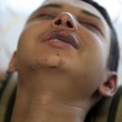 Tariq Abu Khdeir, 15enne palestinese brutalmente picchiato dalla polizia15