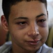 Tariq Abu Khdeir, 15enne palestinese brutalmente picchiato dalla polizia12