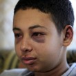 Tariq Abu Khdeir, 15enne palestinese brutalmente picchiato dalla polizia11