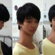Fu Wengui, il ragazzo dal collo lunghissimo: è nato con 3 vertebre in più 02