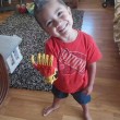Il bimbo di 3 anni che riceve la mano bionica uguale a quella di Iron Man02