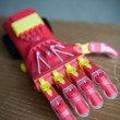Il bimbo di 3 anni che riceve la mano bionica uguale a quella di Iron Man03