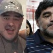 Diego Armando Maradona, lifting a 54 anni: ritocchino al volto 02