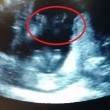 VIDEO YouTube: feto batte le mani a tempo di musica durante ecografia4