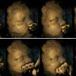 Ecografie 4D mostrano effetti nocivi del fumo fa male sul feto