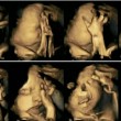 Ecografie 4D mostrano effetti nocivi del fumo fa male sul feto02