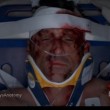 VIDEO YouTube - Derek Shepherd, scena della morte in Grey's Anatomy 02