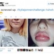 "Kylie Jenner Challenge", labbra a"canotto" sorella di Kim Kardashian imitate su Twitter05