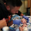 Usa, Eli nasce senza naso: evento rarissimo, solo 37 casi al mondo