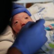 Usa, Eli nasce senza naso: evento rarissimo, solo 37 casi al mondo03