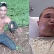 Usa: adolescente prova a baciare serpente, il rettile lo manda all'ospedale 4