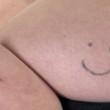 Gb, la ragazza che ha due "smile" tatuati sui seni03