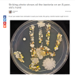 Quanti microbi abbiamo sulle mani? Ecco quella di un bimbo di 8 anni...FOTO
