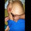 Brasile, santone massaggia pancia: da ombelico dell'uomo esce un topo morto5