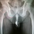 Le radiografie più assurde di incidenti sessuali 07