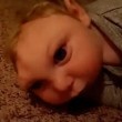 VIDEO YouTube. Bimbo nato con mezzo cranio dice "ciao" a fan5