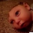 VIDEO YouTube. Bimbo nato con mezzo cranio dice "ciao" a fan4