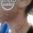 Giulia Di Sabatino, FOTO graffi sul viso dopo una lite2