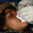Mutila moglie tagliandole naso: orrore in Afghanistan FOTO