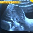 Michelle Hunziker ecografia in tv: "Non sono incinta" VIDEO 2