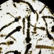 Virus Zika, allarme in Veneto: primi casi vicino Treviso4