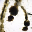 Virus Zika, allarme in Veneto: primi casi vicino Treviso3
