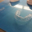 Apparecchio denti con stampante 3D Prezzo 50 euro4