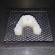 Apparecchio denti con stampante 3D Prezzo 50 euro3