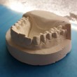 Apparecchio denti con stampante 3D Prezzo 50 euro9