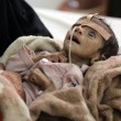Udai Faisal, bimbo 5 mesi morto di fame in Yemen. FOTO choc06