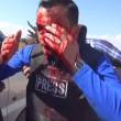 YOUTUBE Reporter colpito da schegge granata in diretta tv 03