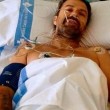Jarabe de Palo, Pau Donés sconfigge tumore: "Sono pulito" 03