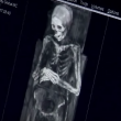 YOUTUBE Mummie misteriose: tac per scoprire causa morte 7