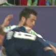 Vieirinha, dente salta durante Wolfsburg-Real Madrid FOTO_4