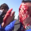 VIDEO YOUTUBE Reporter colpito da scheggia granata in Siria 5