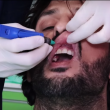 YOUTUBE Fabrizio Corona, spot per una clinica dentistica