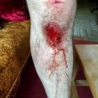 Ciclista preso a calci e pugno FOTO lividi e ferite
