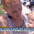 Madre fa bagnetto a figlio con tubo acqua giardino: ustionato 03