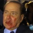Berlusconi, tutti i malanni recenti: dal cancro alla prostata all'uveite