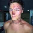 Magaluf: coppia inglese picchiati da guardie spagnole FOTO
