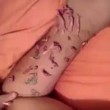 Tatuaggio infetto dalla ciste rimossa col tagliaunghie2