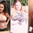 Lyndsey Hoover perde 88 chili: gliene asportano 9 solo di pelle...4