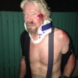 Richard Branson, incidente in bici: "Ho pensato che stavo per morire" FOTO 3