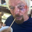 Richard Branson, incidente in bici: "Ho pensato che stavo per morire" FOTO 7