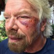Richard Branson, incidente in bici: "Ho pensato che stavo per morire" FOTO 8