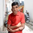 YOUTUBE Elephant Man, il 16enne con la faccia devastata dal tumore01